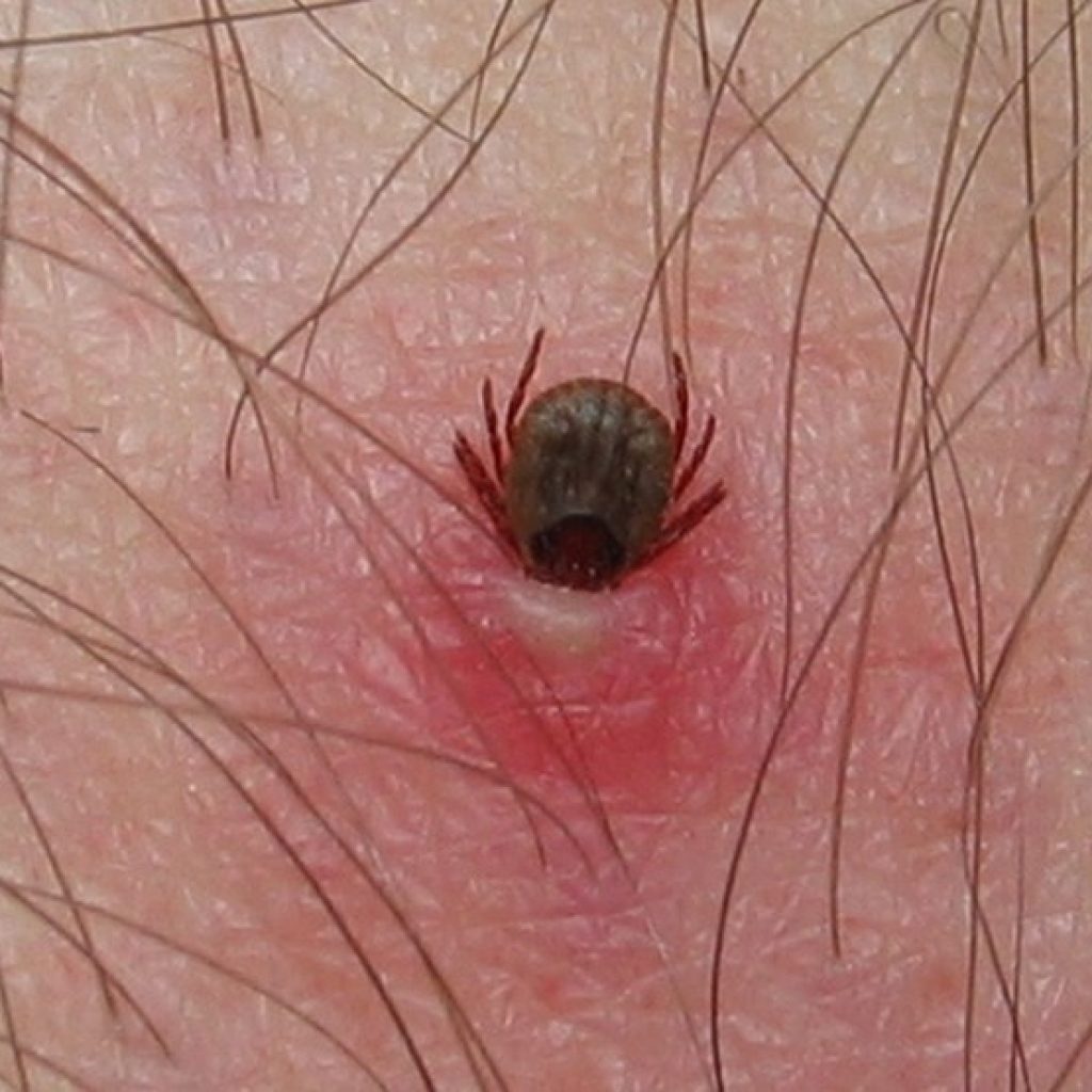 Experts are warning the tick population continues to expand; Lyme disease cases increased from 144 in 2009 to 2,025 in 2017. Ticks are moving between 35-55 km per year and with the recent decades of climate change, Southern Canada is making for a better place for ticks to set up home. Click here for the summary of the article.