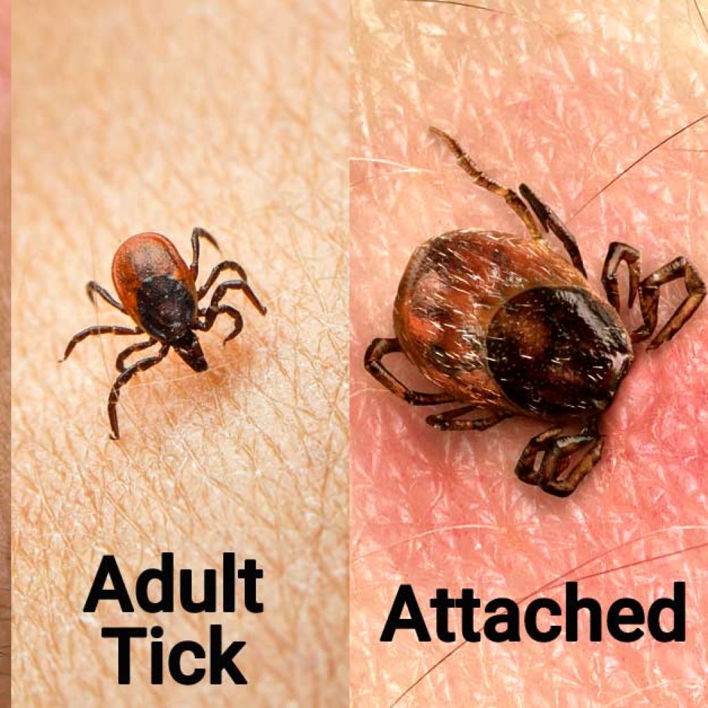 Learn more about Lyme disease and the methods that can be used to prevent it.